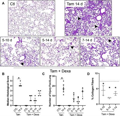 Immunophenotyping of Acute Inflammatory Exacerbations of Lung Injury Driven by Mutant Surfactant Protein-C: A Role for Inflammatory Eosinophils